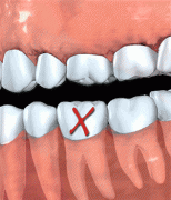 ݰεֲ