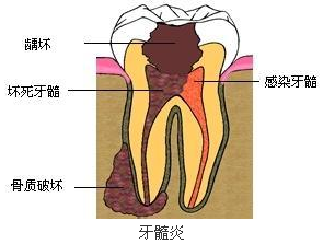 129-1G2251Z512Z4.png