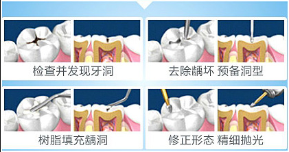 广东省口腔补牙怎么样