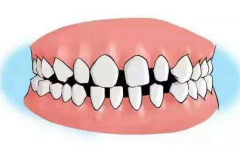 ݺϡô