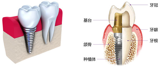 惠安齿科，是矫正牙齿的专家