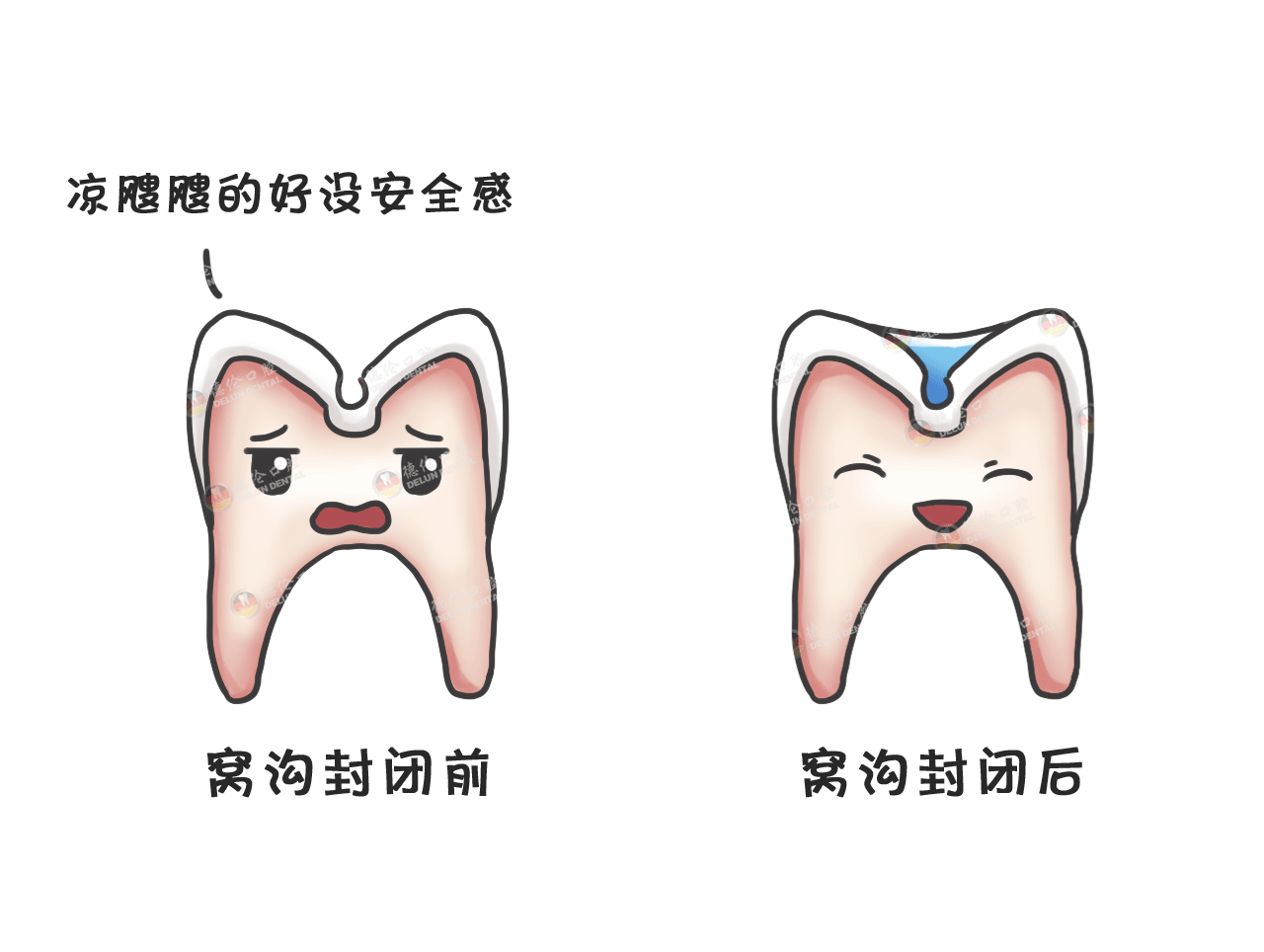 横小集团南上湖校区：窝沟封闭进校园 为牙齿健康护航