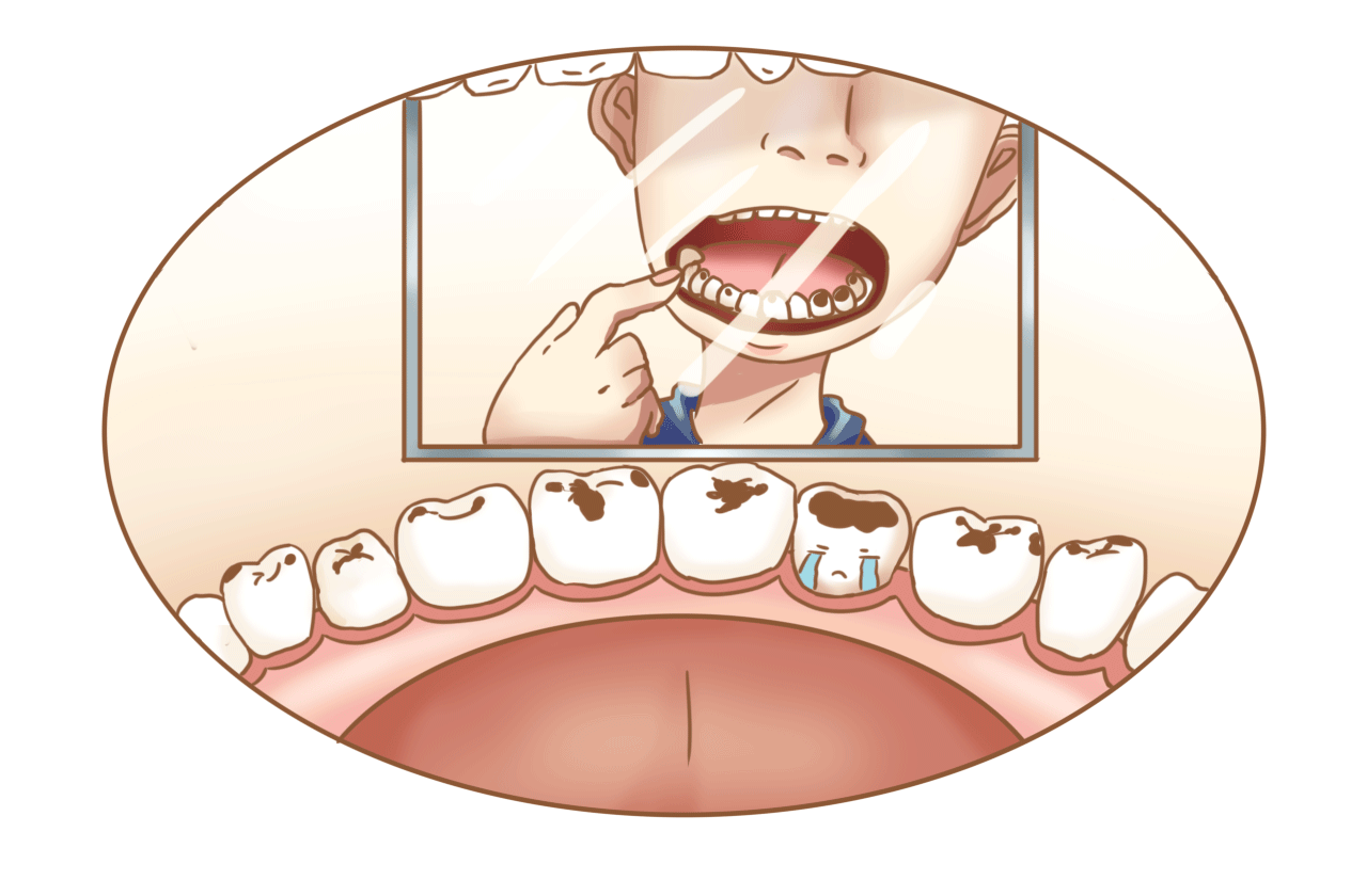 牙龈发黑如何恢复正常?如果非病理原因可选牙龈漂红来改善,牙齿美白-8682赴韩整形网